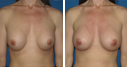 Before & After Photos